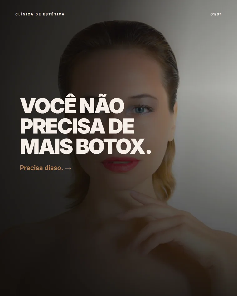 Carrossel Botox, slide 1 de 7