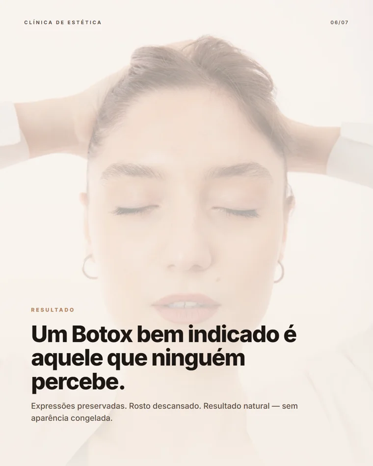 Carrossel Botox, slide 6 de 7
