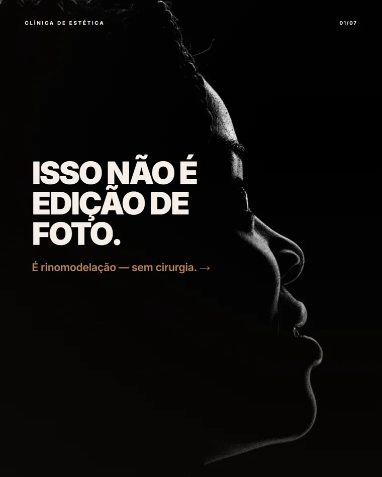 Carrossel rinomodelação, slide 1 de 7