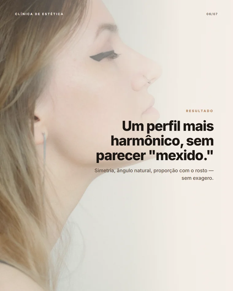 Carrossel rinomodelação, slide 6 de 7